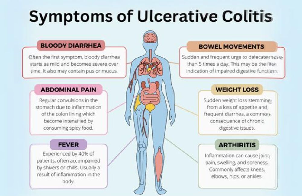 11 Naturopathic and Home Remedies for Ulcerative Colitis 22.jpg